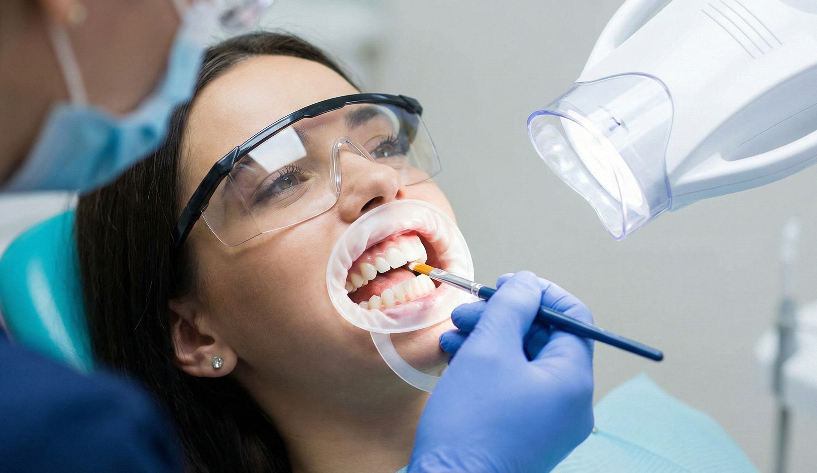 Professional Teeth Whitening Process